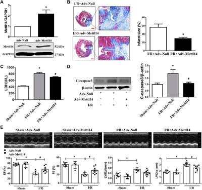 Mettl14 Attenuates Cardiac Ischemia/Reperfusion Injury by Regulating Wnt1/β-Catenin Signaling Pathway